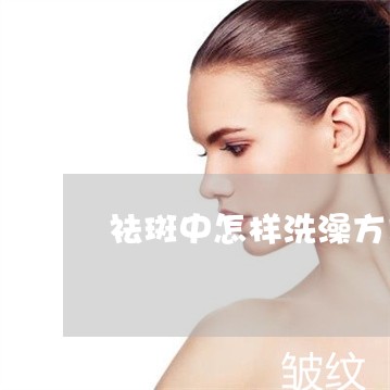 祛斑中怎样洗澡方式水不溅到脸上 祛斑中怎样洗澡方式水不溅到脸上