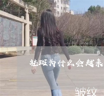 祛斑为什么会越来越多 祛斑为什么会越来越多