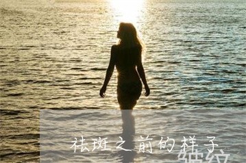 祛斑之前的样子 祛斑之前的样子