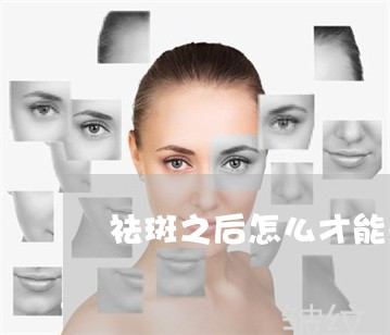 祛斑之后怎么才能去掉 祛斑之后怎么才能去掉