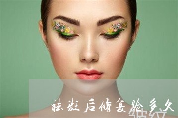 祛斑后修复脸多久掉皮 祛斑后修复脸多久掉皮