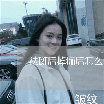 祛斑后掉痂后怎么使用修复产品 祛斑后掉痂后怎么使用修复产品