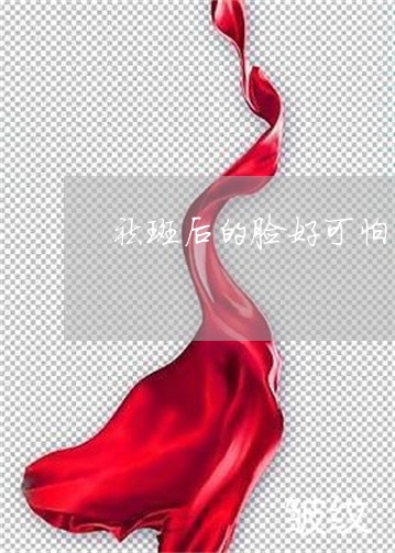 祛斑后的脸好可怕 祛斑后的脸好可怕