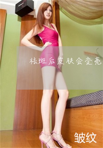 祛斑后皮肤会变亮吗 祛斑后皮肤会变亮吗