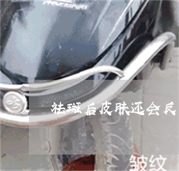 祛斑后皮肤还会反黑吗