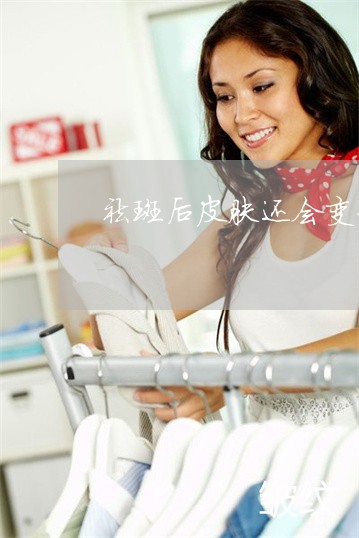 祛斑后皮肤还会变好吗