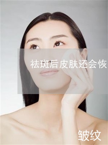祛斑后皮肤还会恢复吗