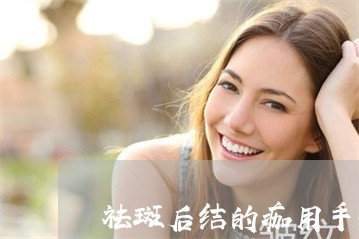 祛斑后结的痂用手抠掉会怎样