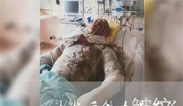 祛斑后能吃莲藕花生吗