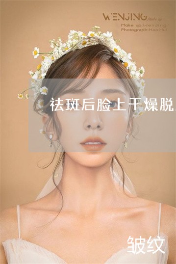 祛斑后脸上干燥脱皮怎么办 祛斑后脸上干燥脱皮怎么办