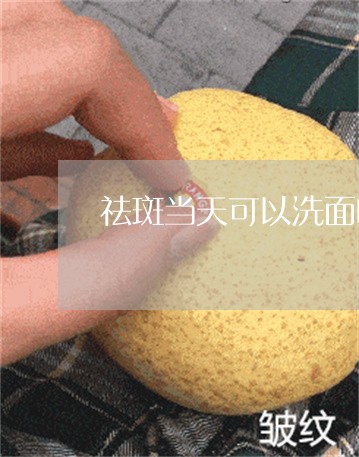 祛斑当天可以洗面吗 祛斑当天可以洗面吗