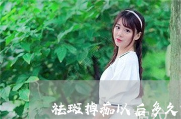 祛斑掉痂以后多久能化妆