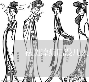 祛斑掉痂后没几天斑又回来了 祛斑掉痂后没几天斑又回来了