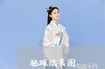 祛斑效果图