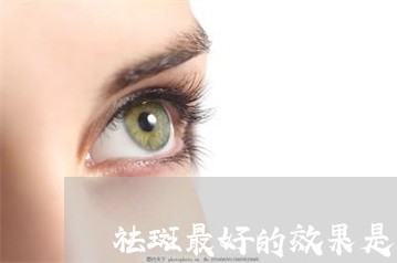 祛斑最好的效果是用什么方法