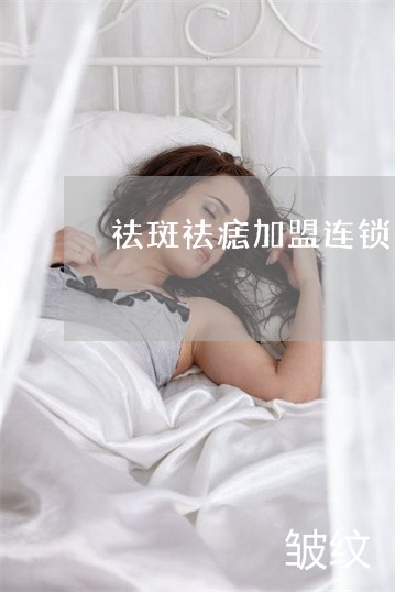 祛斑祛痣加盟连锁 祛斑祛痣加盟连锁