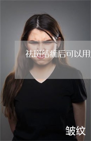 祛斑结痂后可以用定妆粉吗 祛斑结痂后可以用定妆粉吗