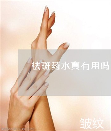 祛斑药水真有用吗