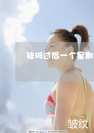 祛斑过后一个星期怎么护理修复 祛斑过后一个星期怎么护理修复