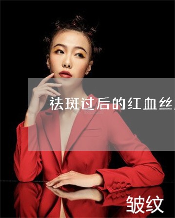 祛斑过后的红血丝脸该用什么面膜 祛斑过后的红血丝脸该用什么面膜