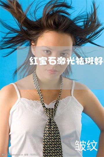 红宝石激光祛斑好吗 红宝石激光祛斑好吗