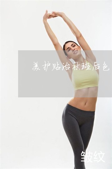 美护贴治祛斑后色素沉着吗 美护贴治祛斑后色素沉着吗