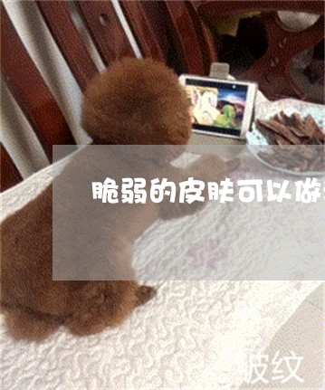 脆弱的皮肤可以做激光祛斑吗 脆弱的皮肤可以做激光祛斑吗