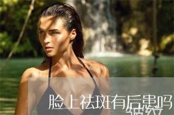 脸上祛斑有后患吗 脸上祛斑有后患吗