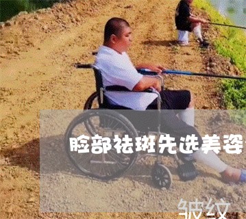 脸部祛斑先选美姿尔官网牛