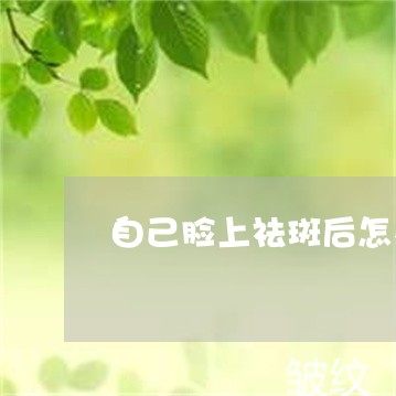 自己脸上祛斑后怎么护理