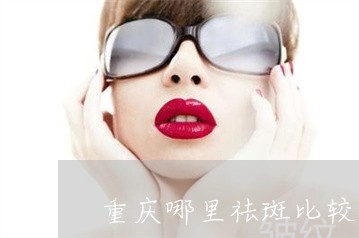 重庆哪里祛斑比较好 重庆哪里祛斑比较好