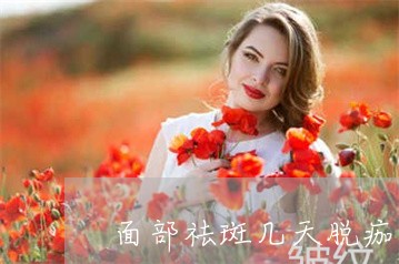 面部祛斑几天脱痂 面部祛斑几天脱痂