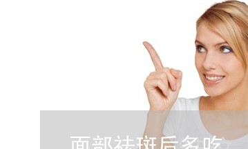 面部祛斑后多吃 面部祛斑后多吃