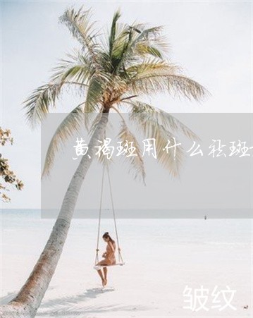 黄褐斑用什么祛斑最好呢 黄褐斑用什么祛斑最好呢