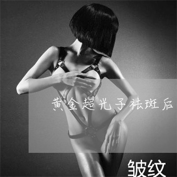 黄金超光子祛斑后多久可以化妆 黄金超光子祛斑后多久可以化妆