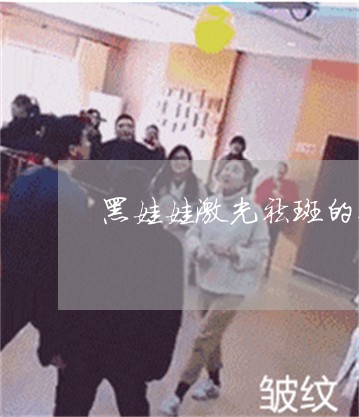 黑娃娃激光祛斑的价格